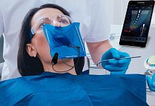 Dental apex locator with touchscreen Wirele-X