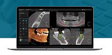 Dental software Dental X image analysismanagementtreatment