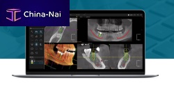 Dental software Dental X image analysismanagementtreatment