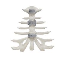 Sternum compression plate KontourTalon ®titanium