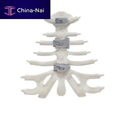 Sternum compression plate KontourTalon ®titanium