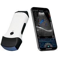 Hand-held ultrasound system SIFULTRAS-5.61for multipurpose ultrasound imagingcolor dopplerconvex-array