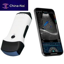 Hand-held ultrasound system SIFULTRAS-5.61for multipurpose ultrasound imagingcolor dopplerconvex-array