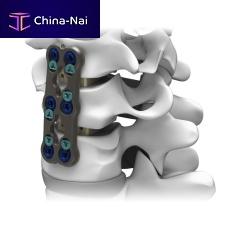Cervical arthrodesis plate GRUVElockingmetallic2 levels