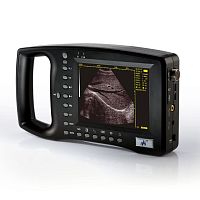 Hand-held ultrasound system WED-3100for multipurpose ultrasound imagingB/Wconvex-array