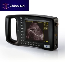 Hand-held ultrasound system WED-3100for multipurpose ultrasound imagingB/Wconvex-array