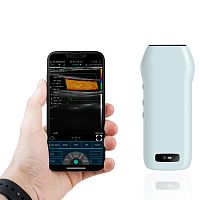 Hand-held ultrasound system C10cxfor multipurpose ultrasound imagingfor urology ultrasound imagingfor breast ultrasound imaging