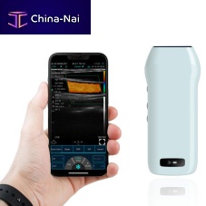 Hand-held ultrasound system C10cxfor multipurpose ultrasound imagingfor urology ultrasound imagingfor breast ultrasound imaging