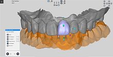 Dental software RAYDENT designerdesignfor tablet PC