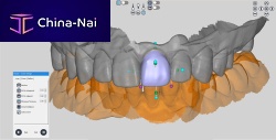 Dental software RAYDENT designerdesignfor tablet PC