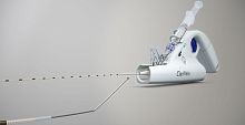Venous catheter ClariVeinsteerable tip