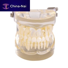 Tooth model H131077 jawdentalfor teaching