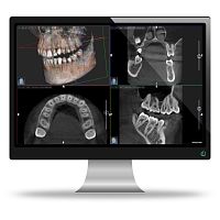 Hospital software AISdentalfor dental imagingradiography