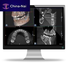 Hospital software AISdentalfor dental imagingradiography