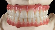 Resin dental material Primefor dental restorationsCAD/CAMtranslucent