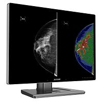 Diagnostic display C1210Gradiologymammographydental