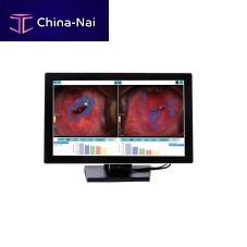 Medical software DYSISmapcolposcopyanalysismanagement