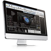 Ultrasound imaging software AmCAD-UT®image analysismanagementreporting