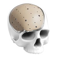 Custom-made cranial implant