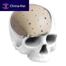 Custom-made cranial implant