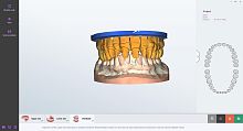 Dental laboratory software orthodonticmanagementdesign