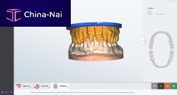 Dental laboratory software orthodonticmanagementdesign
