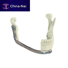 Custom-made mandibular implant non-absorbable