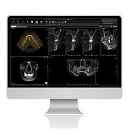 CT software TRIANAdentalanalysisdiagnostic