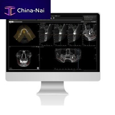 CT software TRIANAdentalanalysisdiagnostic