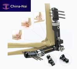 Elbow external fixation system 5934-0000tubularadult