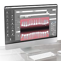 Dental software Quickvisionfor dental imagingvisualizationdiagnostic