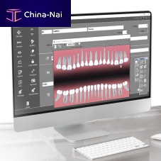 Dental software Quickvisionfor dental imagingvisualizationdiagnostic