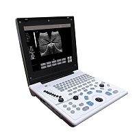 Portable ultrasound system 5520 for multipurpose ultrasound imagingB/Wbuilt-in console