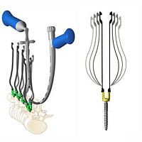 Minimally invasive pedicle screw positioning system Zina