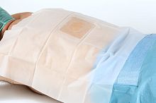 Orthopedic surgery drape 16109800
