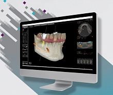 Dental surgery software for dental imagingorthodonticmanagement