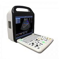 Portable ultrasound system P50for gynecological and obstetric ultrasound imagingcolor dopplerconvex-array