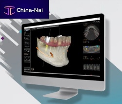 Dental surgery software for dental imagingorthodonticmanagement