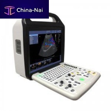 Portable ultrasound system P50for gynecological and obstetric ultrasound imagingcolor dopplerconvex-array