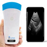Hand-held ultrasound system SIFULTRAS-5.2for gynecological and obstetric ultrasound imagingfor abdominal and pelvic ultrasound imagingfor emergency medicine ultrasound imaging