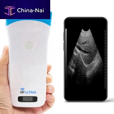 Hand-held ultrasound system SIFULTRAS-5.2for gynecological and obstetric ultrasound imagingfor abdominal and pelvic ultrasound imagingfor emergency medicine ultrasound imaging
