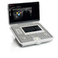 Portable ultrasound system MyLabSigmafor multipurpose ultrasound imagingcolor dopplerB/W