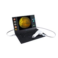 Non-mydriatic retinal camera SW-8000Peye fluorescein angiographyhand-held