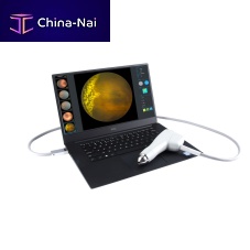 Non-mydriatic retinal camera SW-8000Peye fluorescein angiographyhand-held