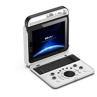 Portable ultrasound system BPU50Bfor multipurpose ultrasound imagingfor gynecological and obstetric ultrasound imagingfor abdominal and pelvic ultrasound imaging