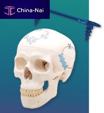 Non-absorbable cranial fixation system NeuroPro® Low