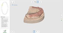 Surgical software for dental laboratoriesfor dental implantologycapture