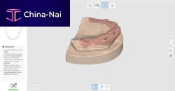 Surgical software for dental laboratoriesfor dental implantologycapture