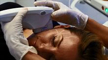 Ultrasound peeling unit Ultherapy®HIFU body contouring unittrolley-mounted