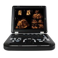 Portable ultrasound system CMS1700Afor multipurpose ultrasound imagingB/W3D/4D